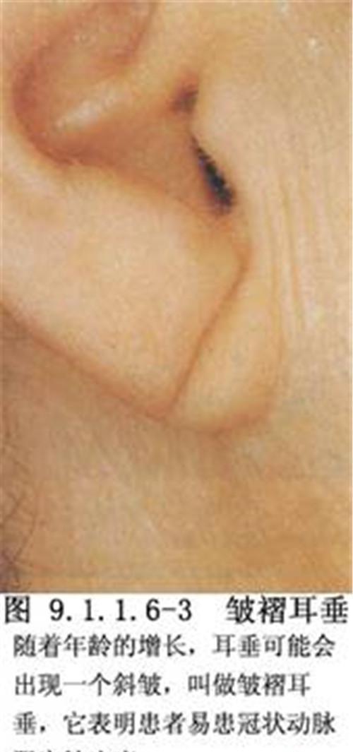 丰耳朵垂儿手术最好的法子都有哪些