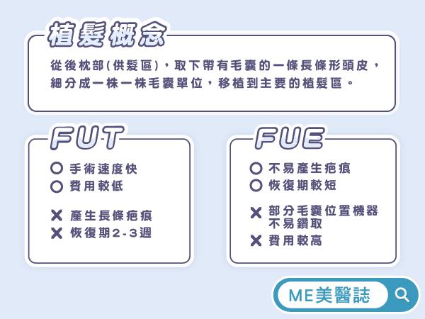 植发fut、植发fue 植发fut、植发fue